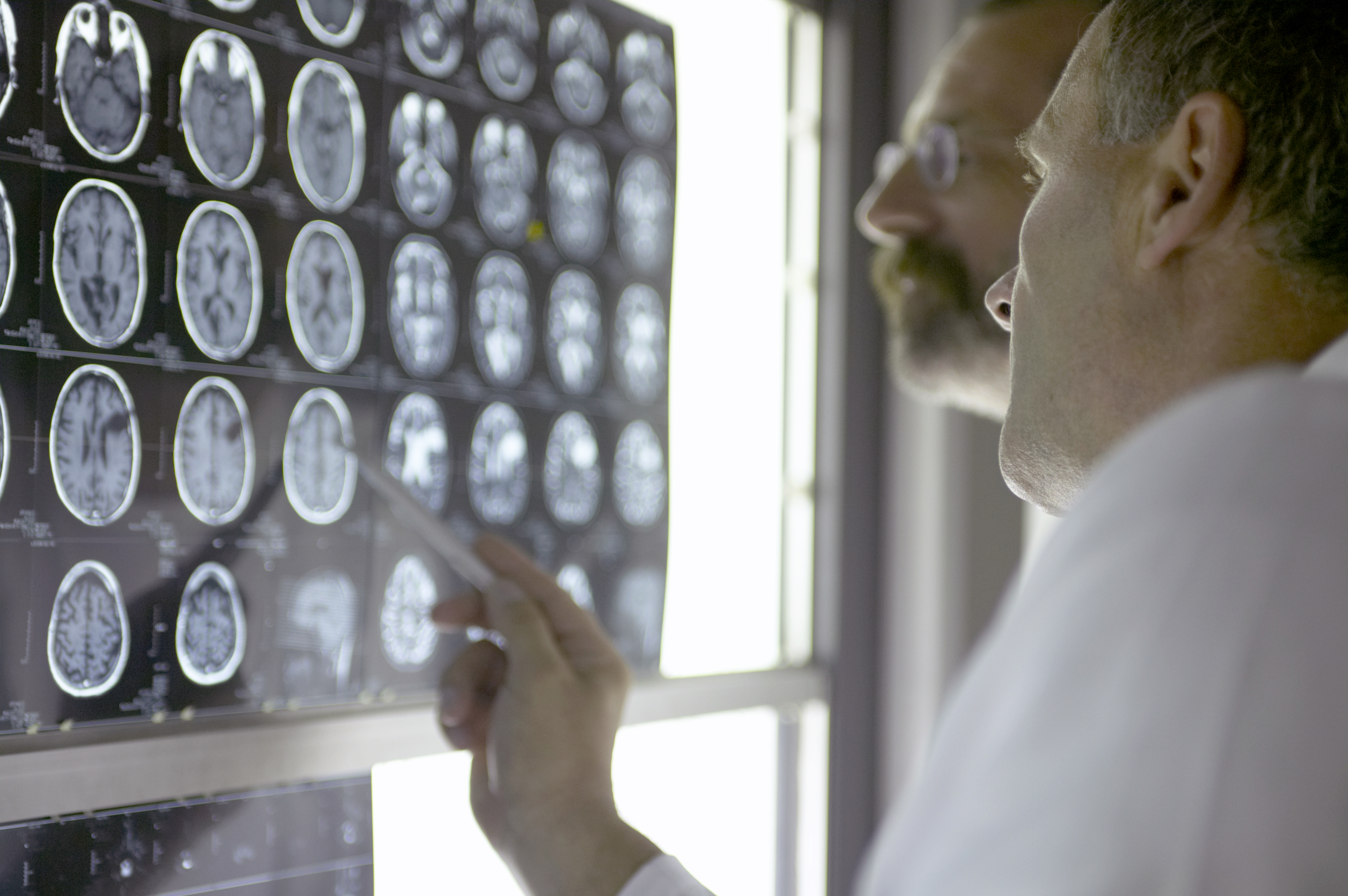 Doctors Looking at X- Rays